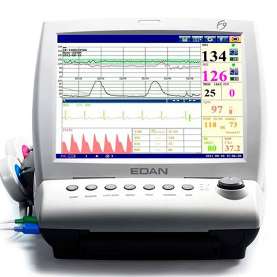 Monitor fetal gemelar...