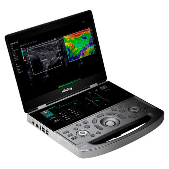 mindray-mx7